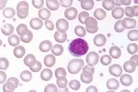 Lymphocyte x400